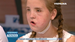 Первая красавица без лица (полный выпуск) | Говорить Україна